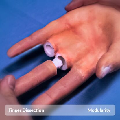 Finger Dissection